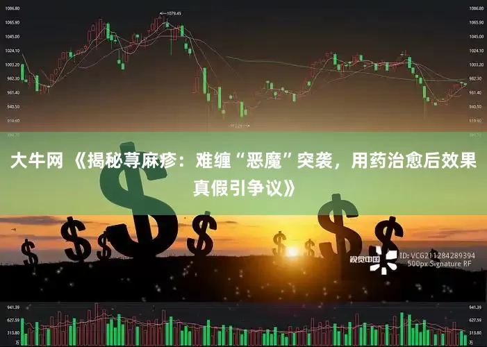 大牛网 《揭秘荨麻疹：难缠“恶魔”突袭，用药治愈后效果真假引争议》